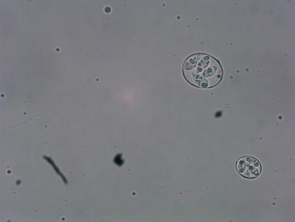 Microscopic coccidiosis image